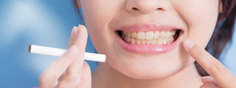 Cómo cuidar el color de los dientes - Efectos del tabaco