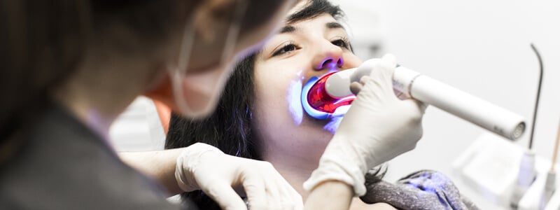 Blanqueamiento dental - Expertos en estética dental
