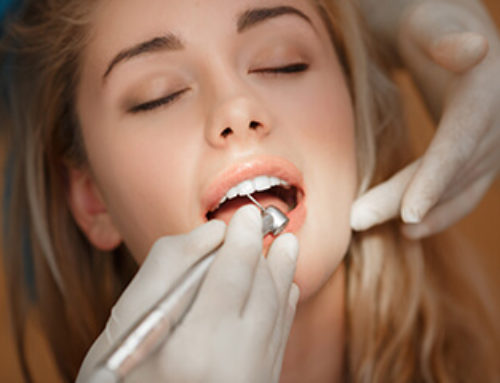 ¿Cómo se reconstruye un diente endodonciado?