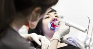 Blanqueamiento dental - Clínica Dental Luciano Badanelli.
