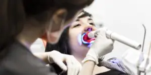 Blanqueamiento dental - Clínica Dental Luciano Badanelli.
