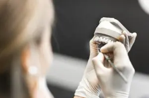 Carillas de porcelana - Preparación del diente e impresiones