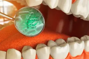 Prevención e higiene dental - Mal aliento