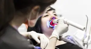 Blanquear los dientes - Blanqueamiento dental combinado