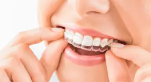 Tipos de ortodoncia removible