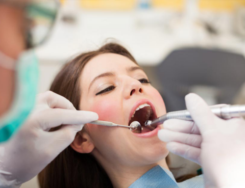 ¿Qué es una endodoncia? Te lo explicamos